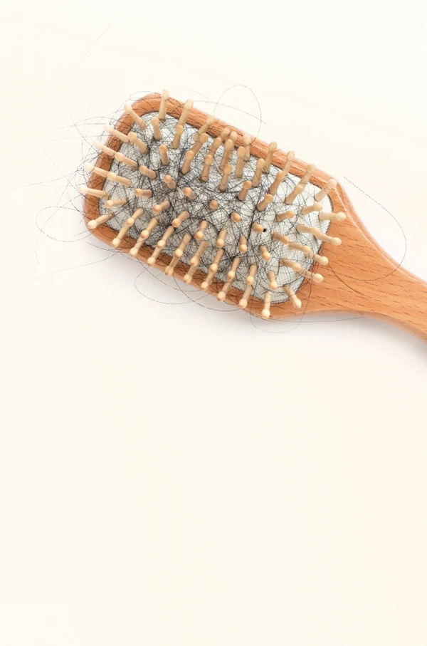 Escova cheia de fios de cabelo. São listadas causas comuns da queda capilar.