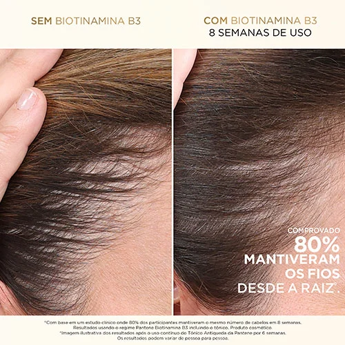 Imagem do produto: Tônico capilar antiqueda + Biotinamina B3 para todos os tipos de cabelo.
