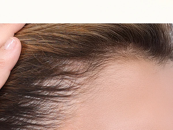 Couro cabeludo sem Biotinamina B3