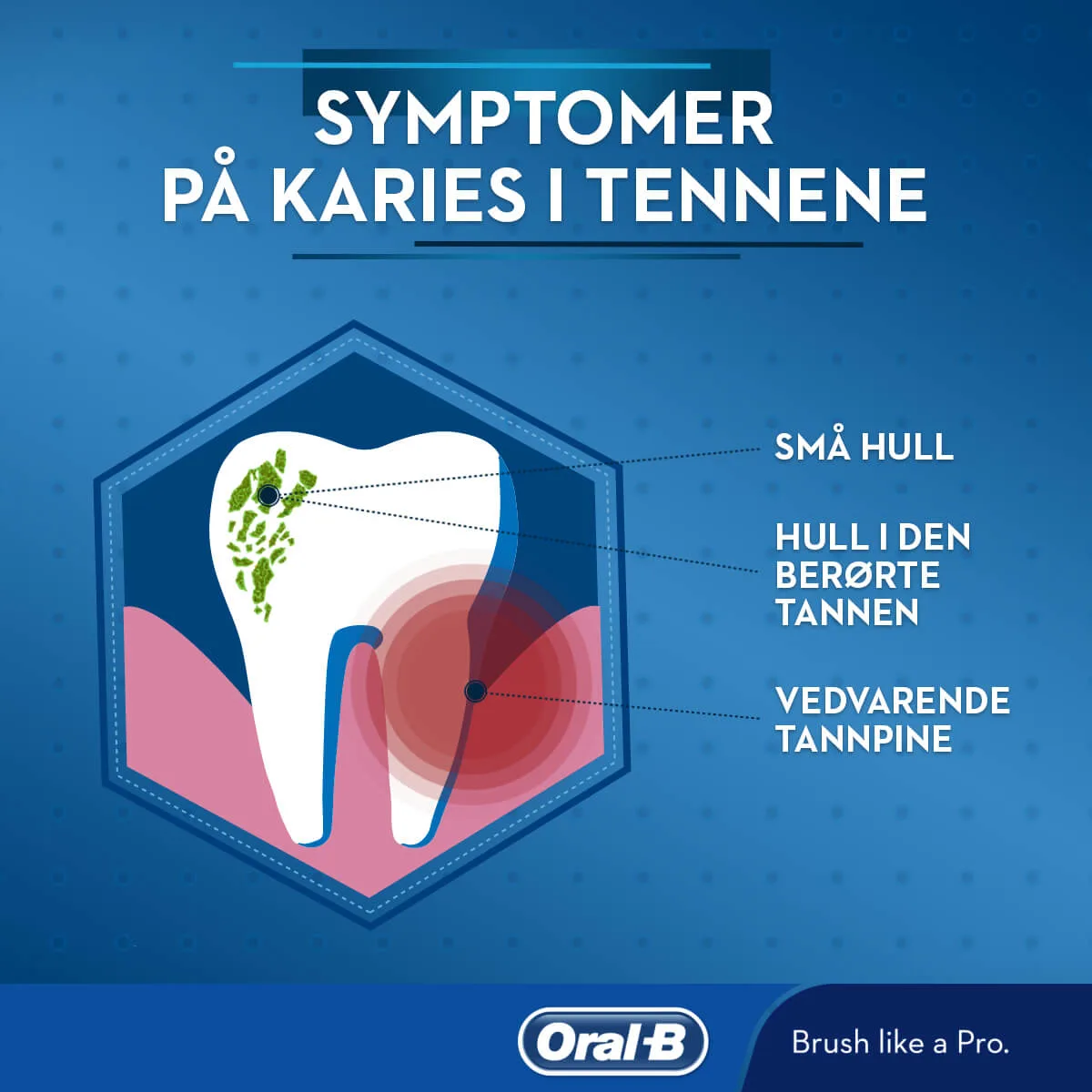 Hva er dental karies? Behandlinger, tegn og symptomer 