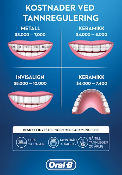 Retainer For Tenner: Typer Kostnad Og Rengjoeringstips - 3