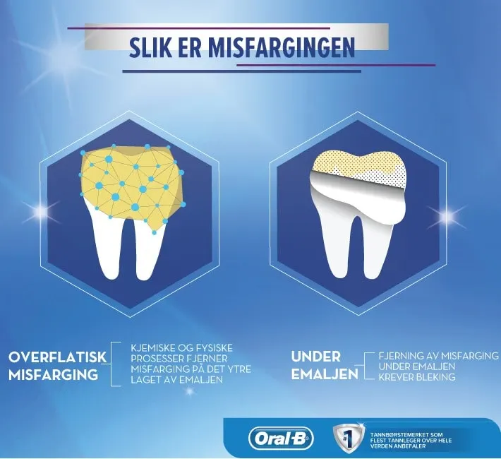 Slik fjerner man misfarging  