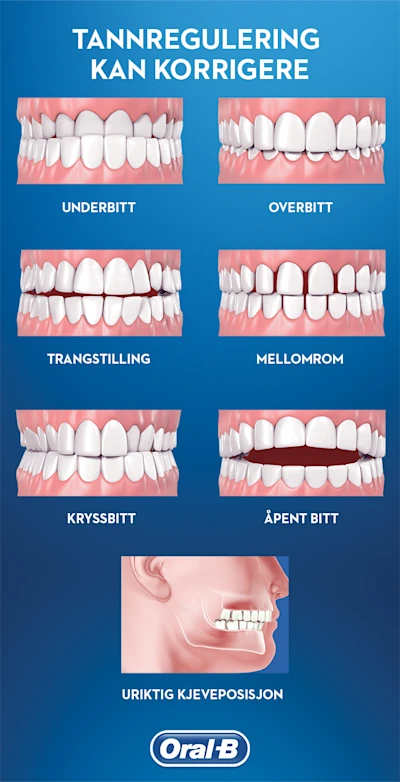 Braces Can Correct