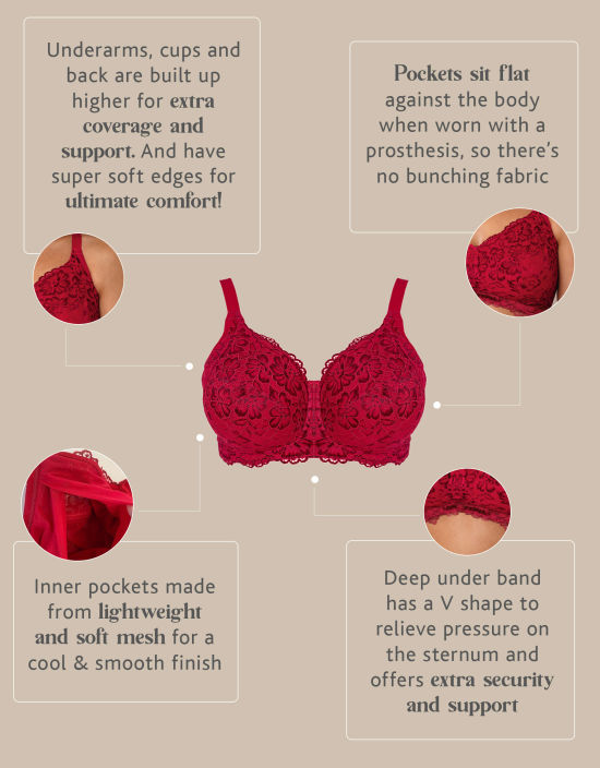 What Type of Bra Can Be Worn With an External Prosthesis?- A