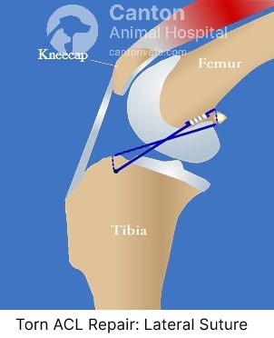 This ACL repair model illustrates the Lateral Suture Stabilization (LLS) technique, showing how an extracapsular suture restores knee stability in dogs. learn more at Canton animal hospital, Michigan