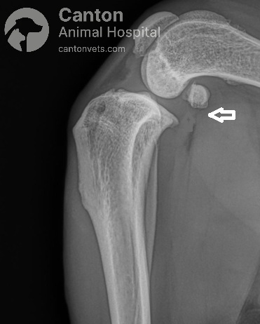 See an X-ray of a torn cranial cruciate ligament (CCL) in a dog showing "fat pad sign". Learn about diagnosis, treatment, and recovery options at Canton Animal Hospital in Michigan.