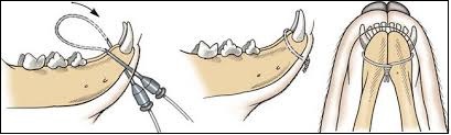 Illustration showing interdental wiring technique used to stabilize mandibular symphyseal fractures in dogs and cats. A minimally invasive method for precise jaw alignment.