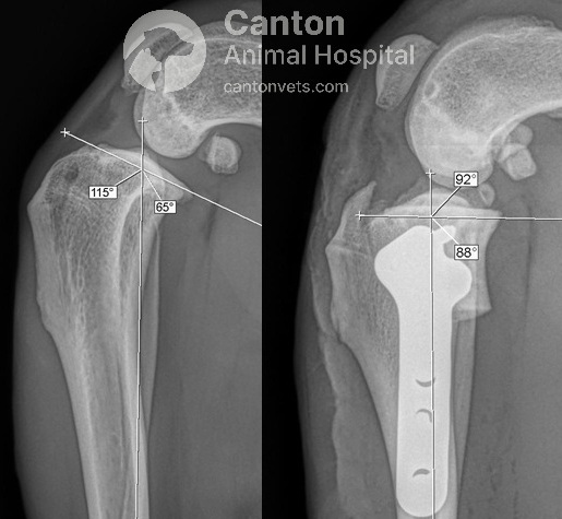 This post-TPLO surgery X-ray shows a tibial plateau angle (TPA) reduction from 25° to 2°, restoring knee stability and preventing cranial tibial thrust in dogs.