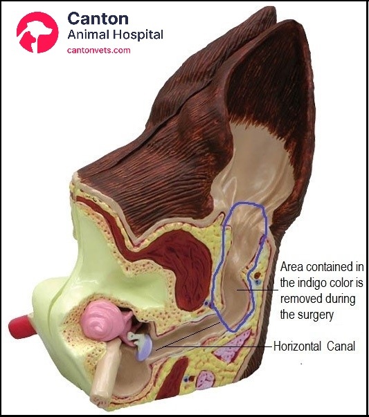 Illustration of vertical ear canal ablation showing complete removal of the vertical canal while preserving horizontal canal and ear flap.