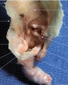 Post-operative view of a dog after Total Ear Canal Ablation and Bulla Osteotomy (TECA-BO), showing surgically removed ear canals to resolve chronic ear disease.