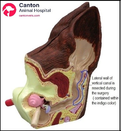 Illustrated view of the Zepp Procedure showing surgical removal of the lateral wall of the vertical ear canal to improve drainage and ventilation.