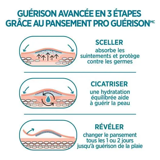 Les pansements adhésifs Band-Aid Pro Guérison offrent une guérison avancée en 3 étapes : sceller, cicatriser et révéler