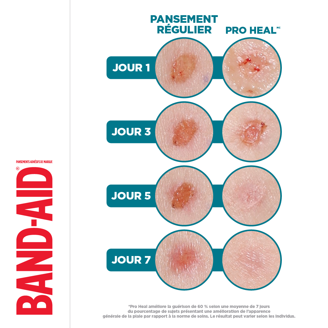 Pansements réguliers par rapport aux pansements PRO HEAL™ de la marque BAND-AID® au jour 1, 3, 5 et 7