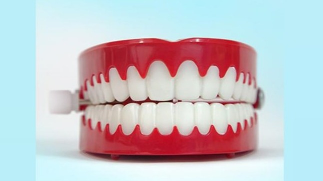 dental occlusion mold