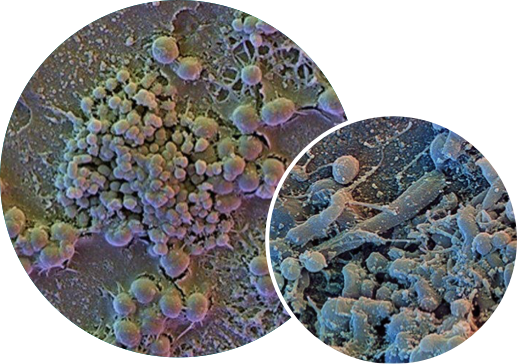 2 images graphiques côte à côte du biofilm de la plaque dentaire