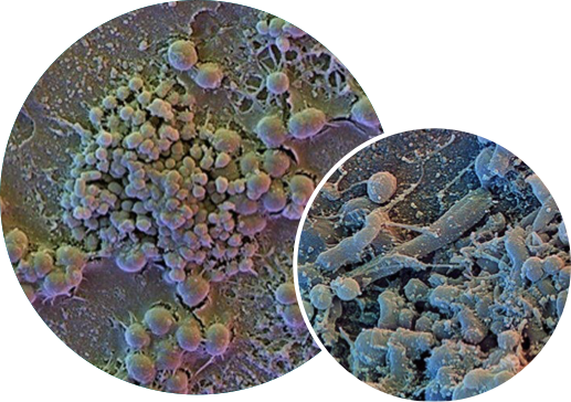2 images graphiques côte à côte du biofilm de la plaque dentaire