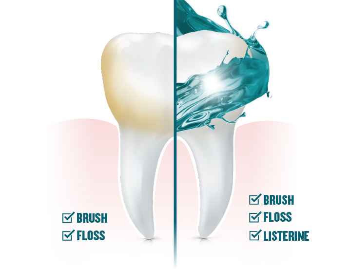 A graphic image of a tooth showing listerine mouthwash is being used on one half along with brushing and flosing.