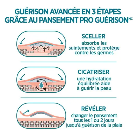 Les pansements adhésifs Band-Aid Pro Guérison offrent une guérison avancée en 3 étapes : sceller, cicatriser et révéler