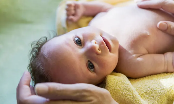 Newborn head with a cradle cap condition