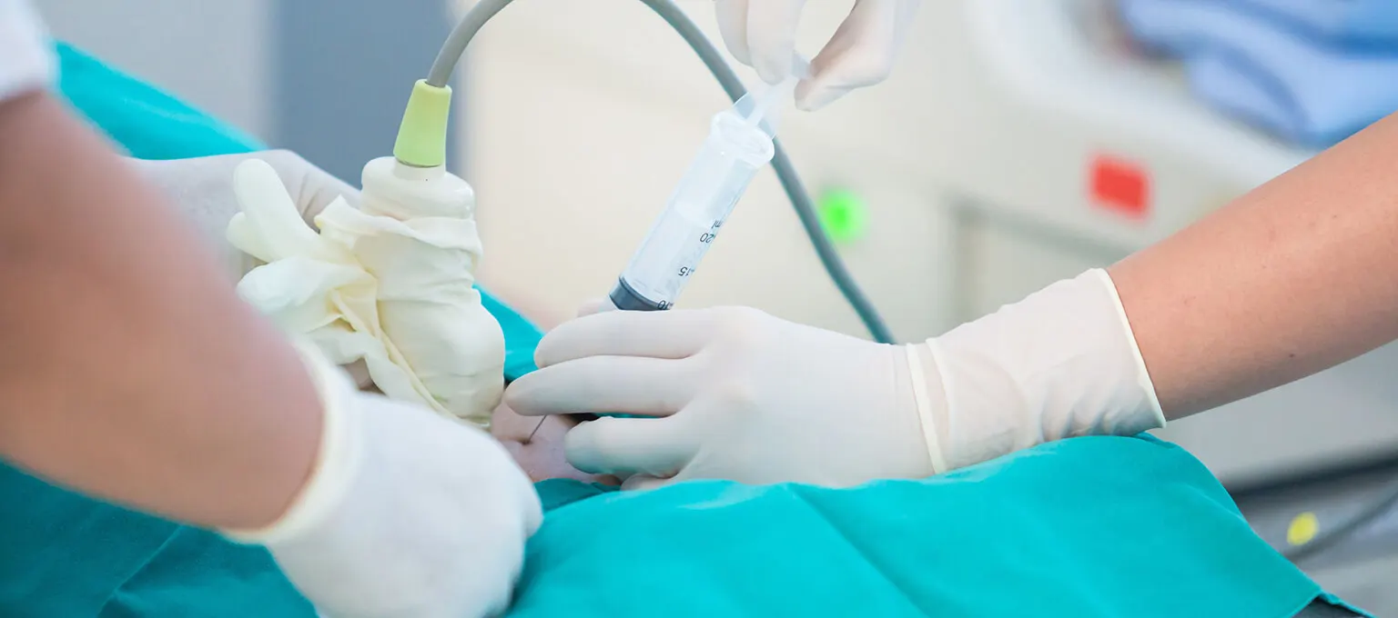 amniocentesis-Article Content Image 1 Amniocentesis procedure