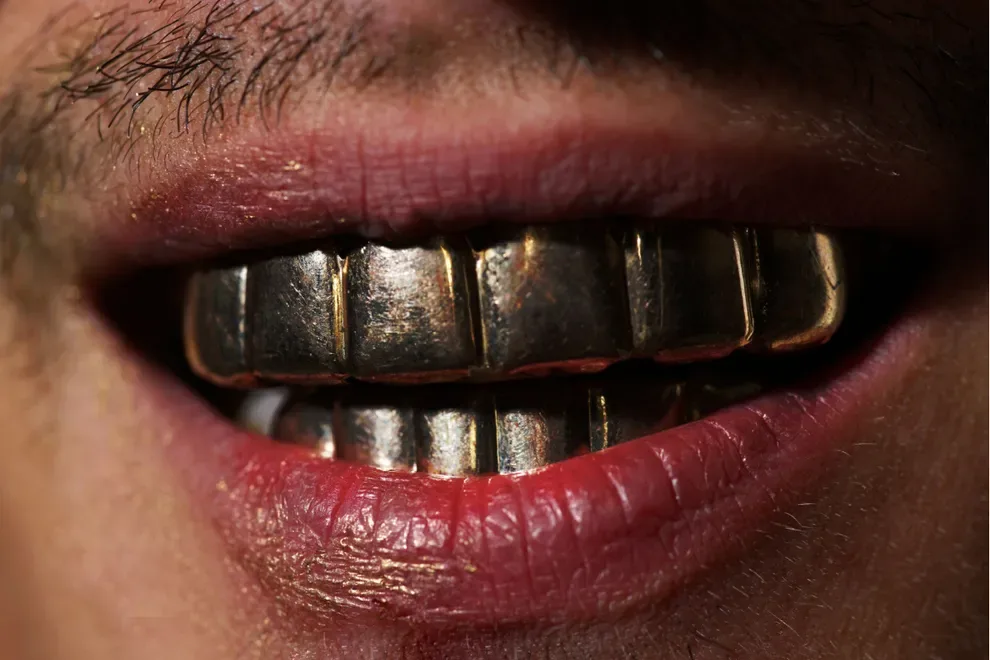 person-with-gold-grillz