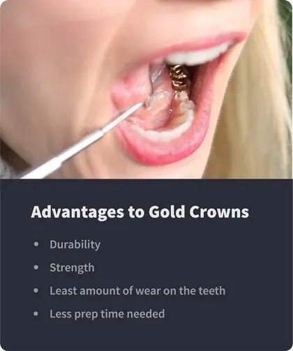 Advantages to Gold Crowns