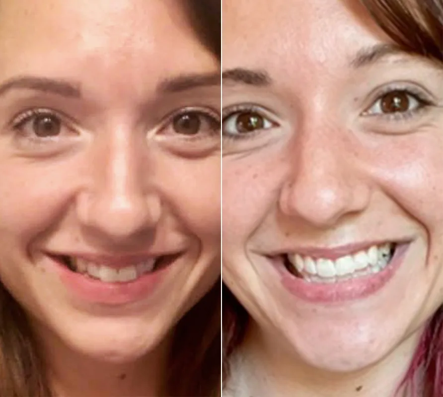 Byte Protection Plan Byte®