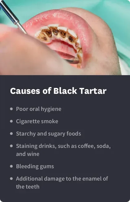 causes of black tartar