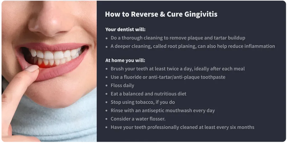 How to Reverse and Cure Gingivitis