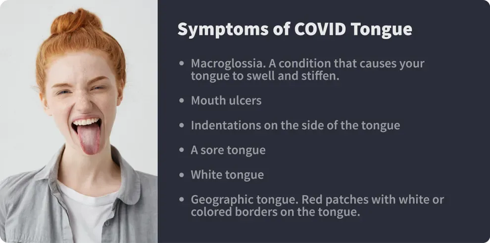 symptoms of covid tongue