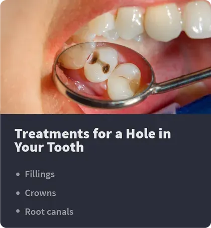 treatments for a hole in the tooth