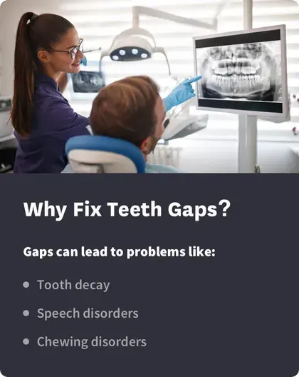 Why Fix Teeth Gaps