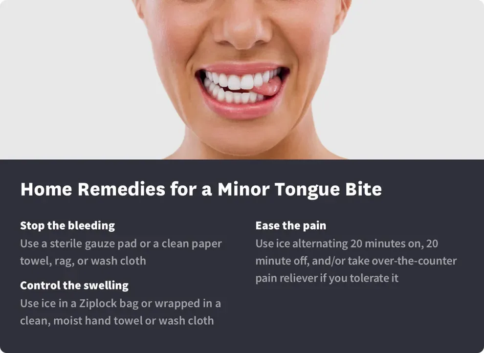 home remedies for a minor tongue bite