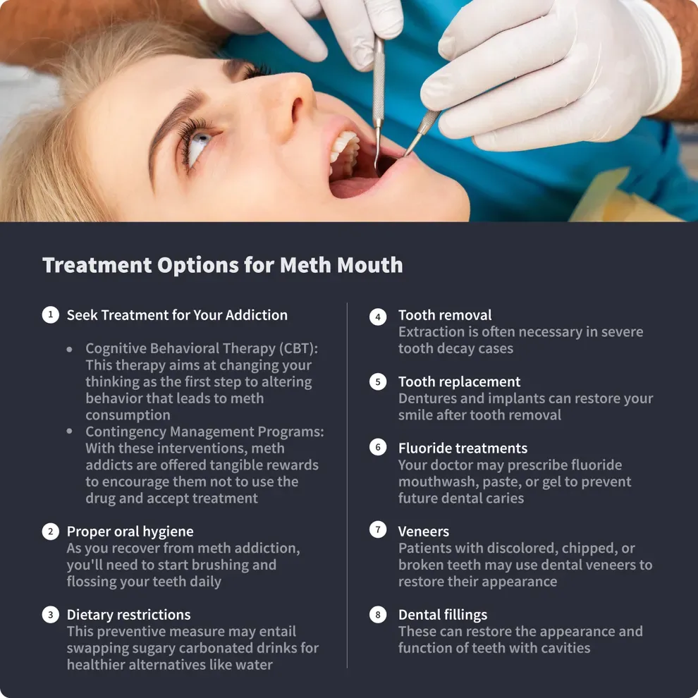 treatment options for meth mouth