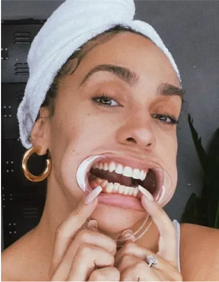 instagram-masonry_Woman with check stretcher in mouth