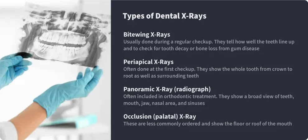 types of dental x rays