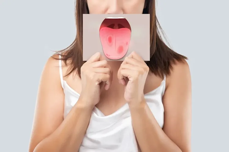 Are Warts on the Tongue Dangerous? Byte® Byte®
