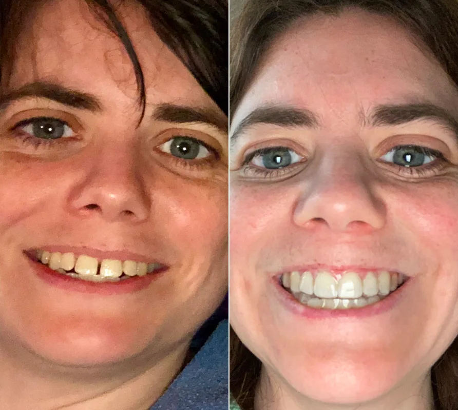 Byte Protection Plan Byte®