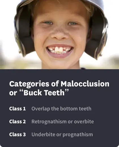 Categories of Malocclusion or Buck Teeth