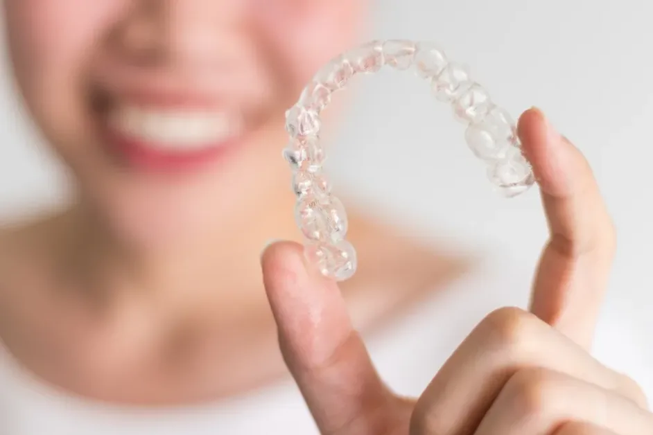 Aligners: How Should They Fit? Tips to Getting the Right Fit