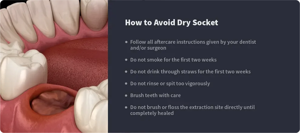 How to Avoid Dry Socket
