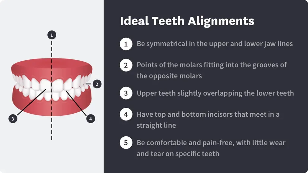 ideal teeth alignment