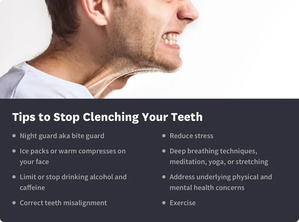 Tips to Stop Clenching Your Teeth