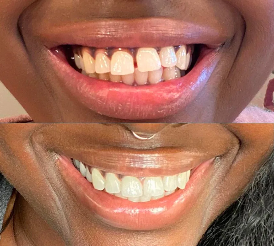 Byte Protection Plan Byte®