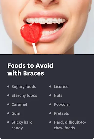 What You Can and Can’t Eat with Braces | Byte® | Byte®