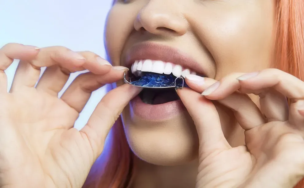 What are the Results of Not Wearing Your Retainer?