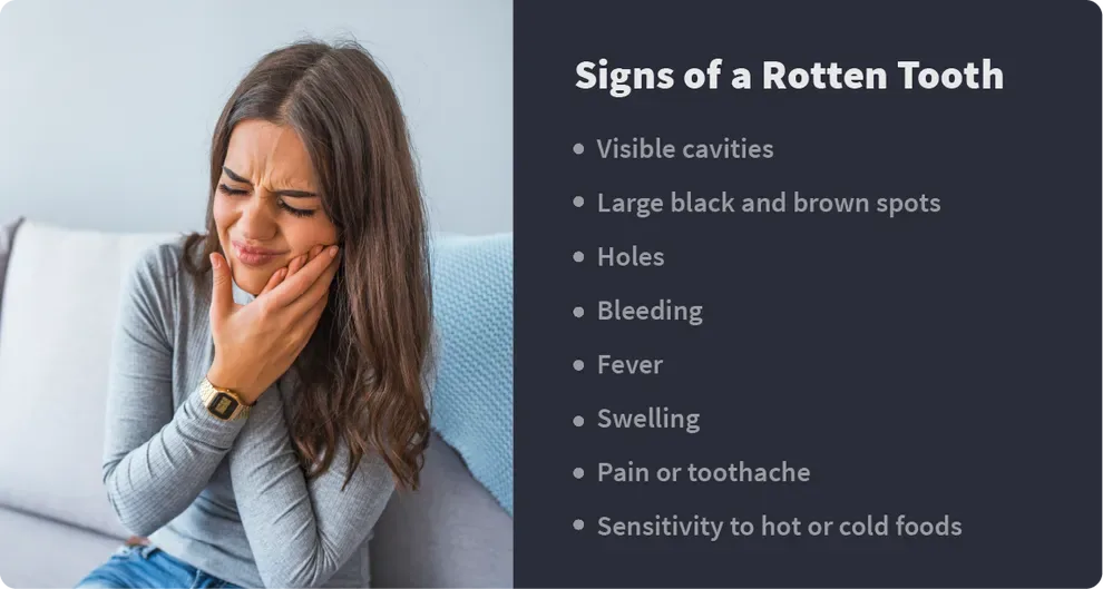 signs of a rotton tooth
