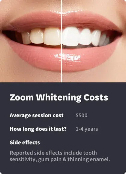Zoom Whitening Costs