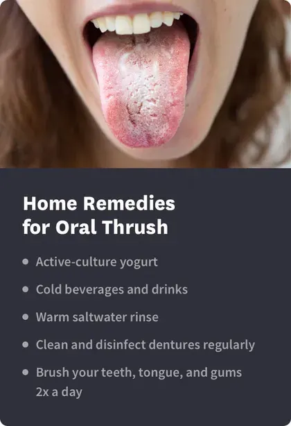home remedies for oral thrush