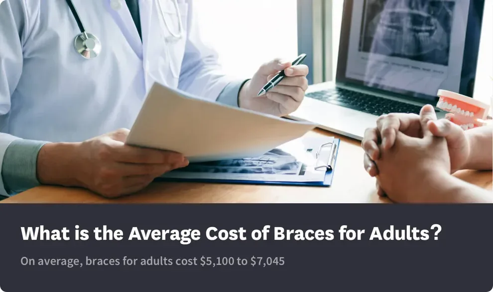 Braces for Adults A Cost Comparison Guide Byte® Byte®